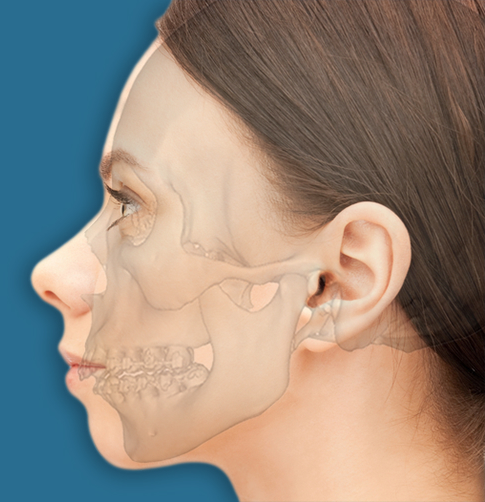 cirurgia face curta